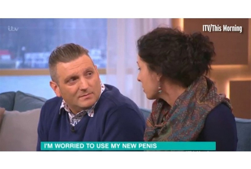 Biyonik penisli adam anlattı : İki hafta boyunca... - Resim: 3