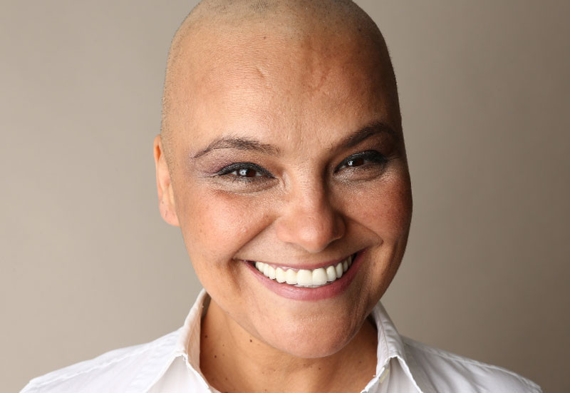 Kanser hastalarının kabusu son buldu! Bu yöntemle saçlar dökülmeyecek - Resim: 3