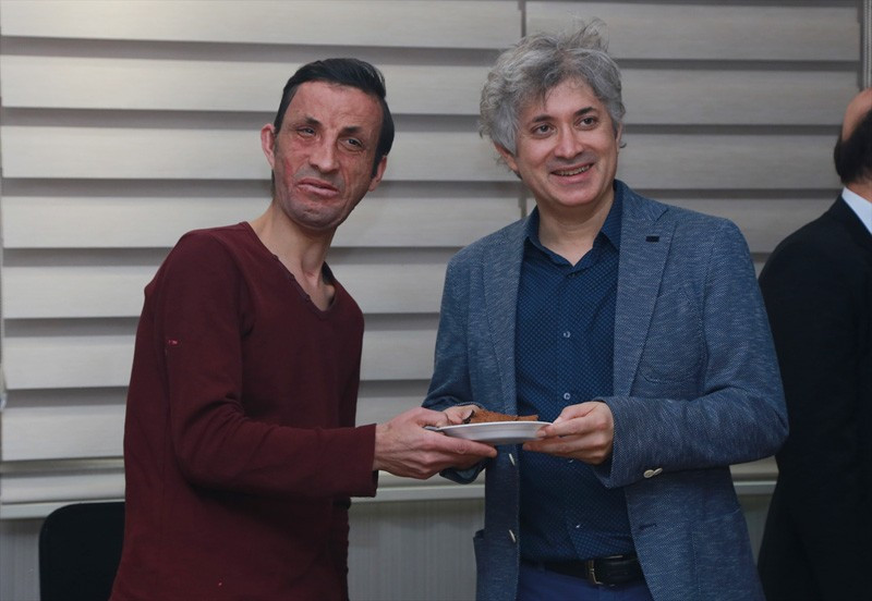 İlk yüz nakli yapılan Uğur Acar 5 yıl sonra böyle konuştu - Resim: 2