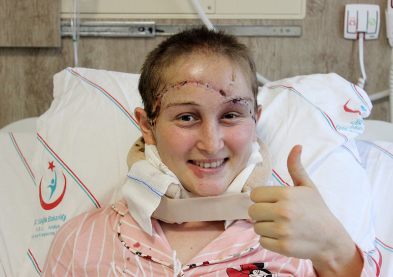 Baş derisi kopan Binnaz'ın anlattıkları dehşete düşürdü - Resim: 1