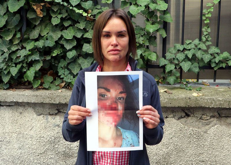 Ankara'da kocasından şiddet gören Rus güzellik uzmanı evinde ölü bulundu - Resim: 1