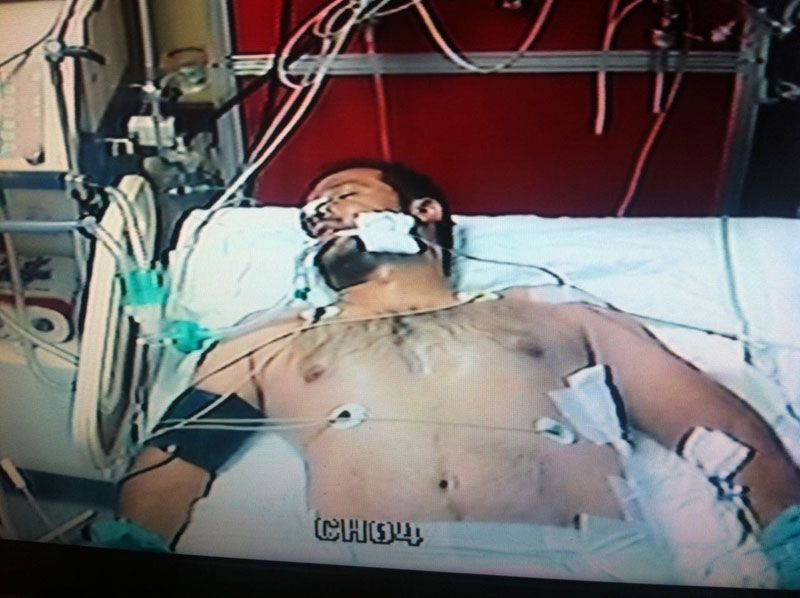 Boğulma tehlikesi geçirdi 15 kurşun yedi elektrik çarptı trafik kazası geçirdi lakabı kedi oldu - Resim: 3