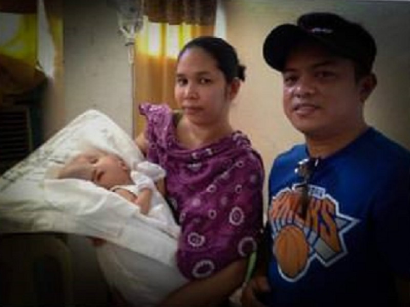 Yüzünde et parçasıyla doğdu! Son haline bakın - Resim: 1