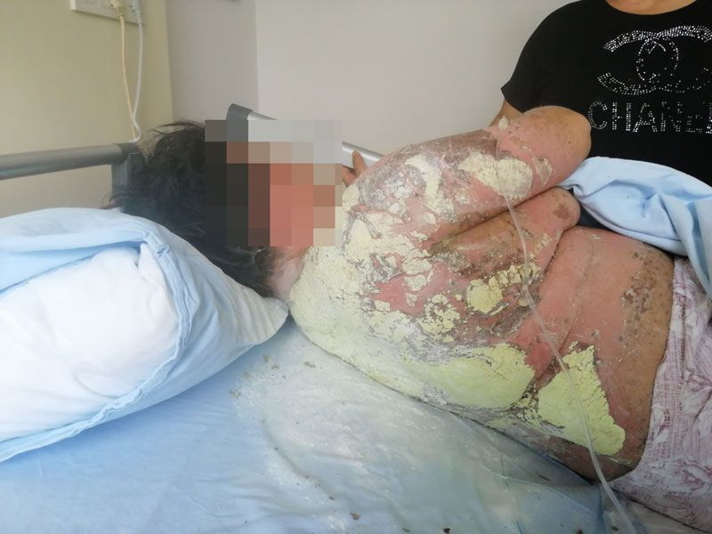 Samsun'da genç kız tanınmaz hale geldi önce hayatı sonra gözleri karardı - Resim: 2