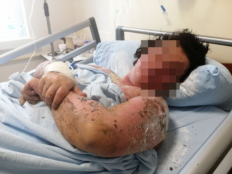 Samsun'da genç kız tanınmaz hale geldi önce hayatı sonra gözleri karardı - Resim: 3