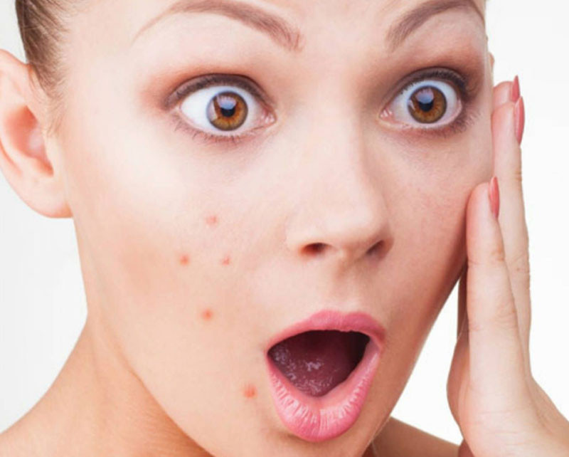 Sivilcenizi sakın bir daha sıkmayın! Sonuçları çok ağır olabilir - Resim: 3