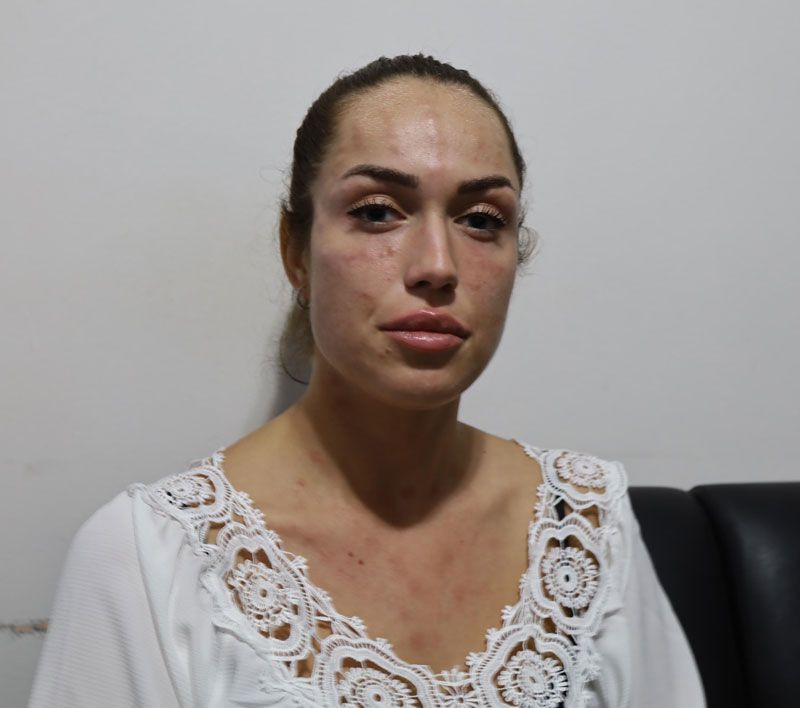 İzmir'de 'gençlik aşısı' yaptıran genç kadın kabusu yaşadı soluğu savcılıkta aldı - Resim: 2