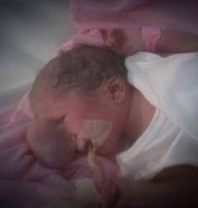 Yüzünde et parçasıyla doğdu! Son haline bakın - Resim: 2