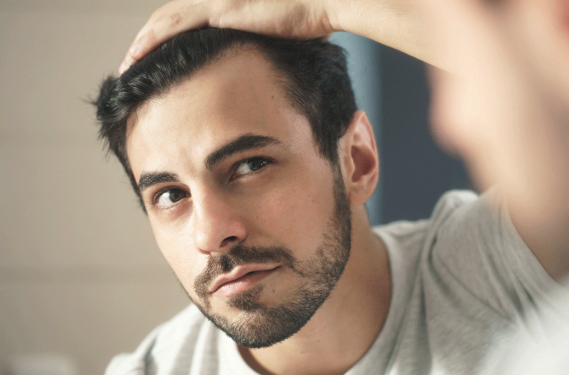 Saç ekimi yapacaklar dikkat! Bu 4 aşamayı dikkate almazsanız... - Resim: 1