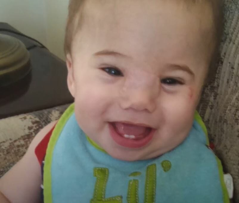 Bebeğin yüzündeki yumru gittikçe büyüyordu doktor gördü ve... - Resim: 3