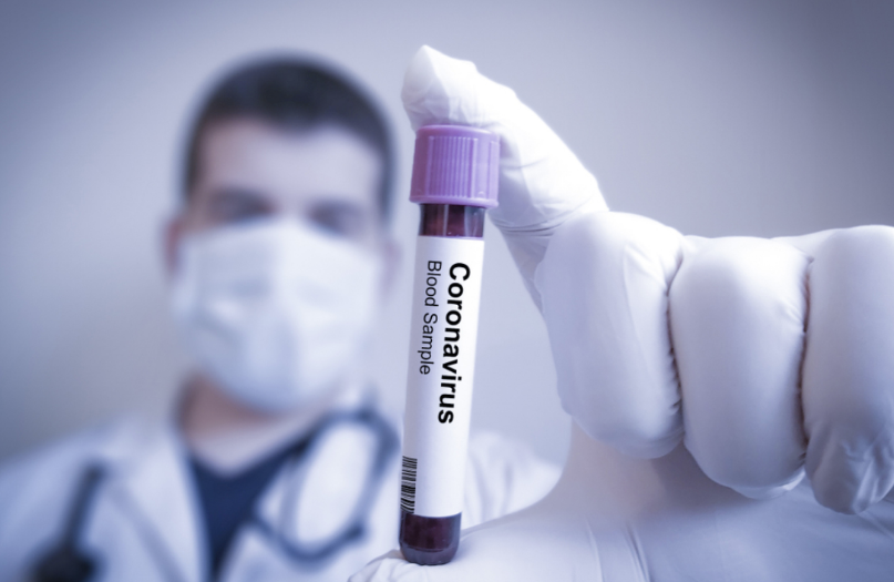 Neden Çin aşısı aldık güvenli mi fiyatı kaç lira? Bakan Fahrettin Koca açıkladı - Resim: 4