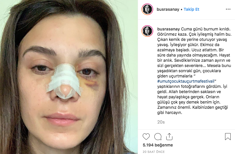 CNN Türk spikeri Büşra Sanay'ın son hali korkunç! Yüzü tanınmaz hale geldi - Resim: 3