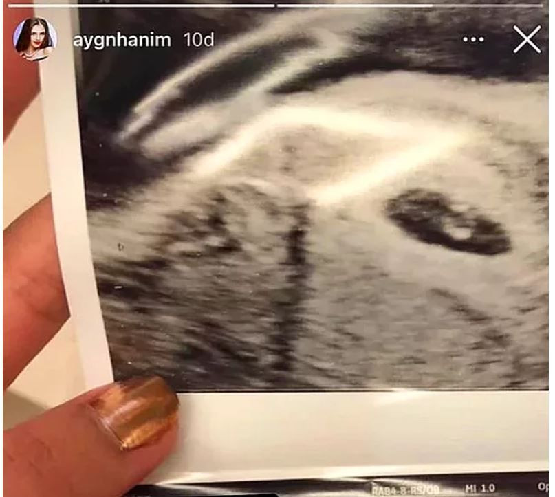 Aygün Aydın Hakan Sabancı'dan bebek mi dünyaya getirdi? 'Şerefsizin kızı' fotoğrafı - Resim: 3