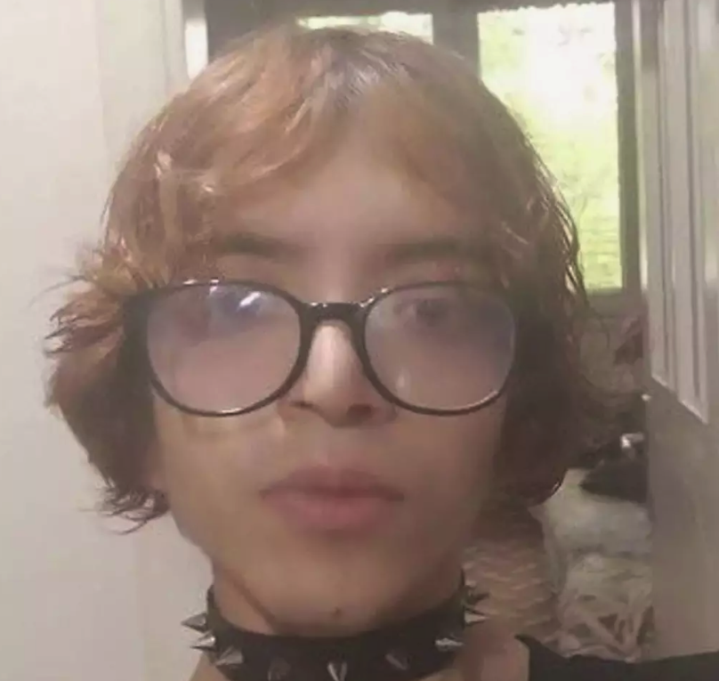 'Tablet Reis' adıyla tanınan Onurcan Güzel 5 ayrı yüz ameliyatı oldu, tanınmaz hale geldi! - Resim: 4