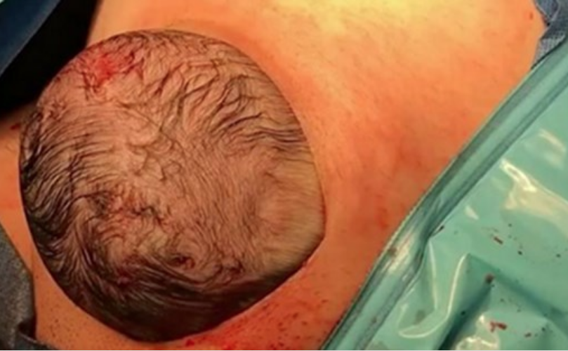 Bu anı gören doktorlar oradan kaçtı bebek bekleyemedi - Resim: 2