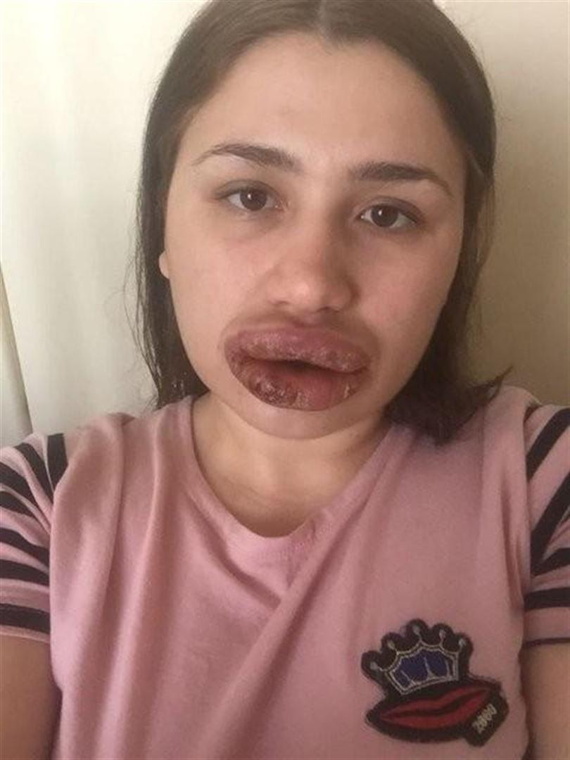 Dudakları dünya tıp literatürüne girebilir - Resim: 2