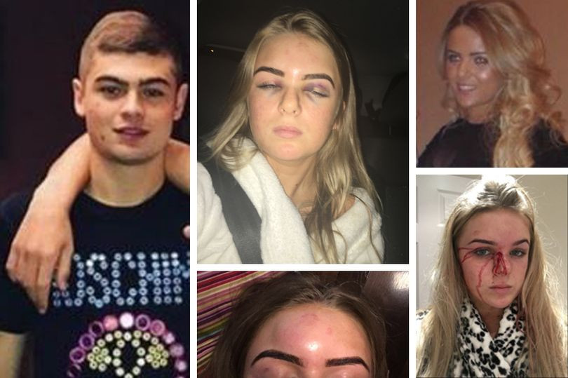 Canını zor kurtardı! Pencereden aşağı atlayıp çırılçıplak kaçtı - Resim: 1