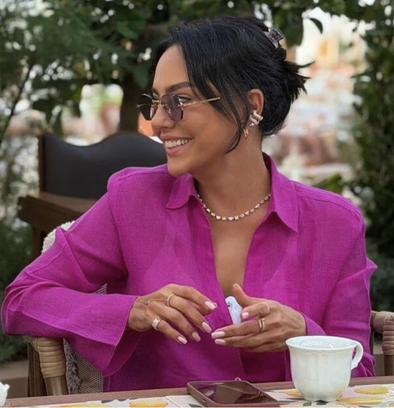 Estetik yaptırdığını açıklamıştı! Ebru Gündeş'ten olay kareler... - Resim: 5