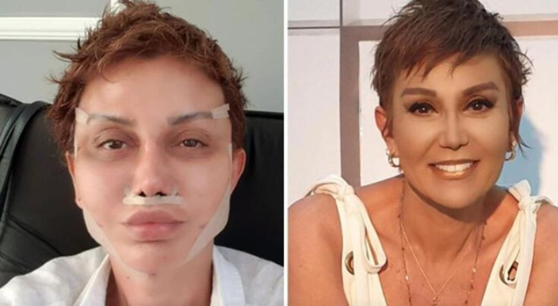 Serap Paköz estetik yaptırdı bambaşka biri oldu: Benim Seda Sayan'dan neyim eksik! - Resim: 3