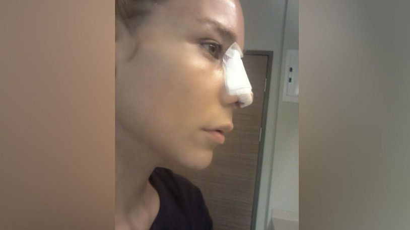 Ebru Şallı'nın eşi Uğur Akkuş’a mahkemeden kötü haber! Burnunu kırmıştı - Resim: 3