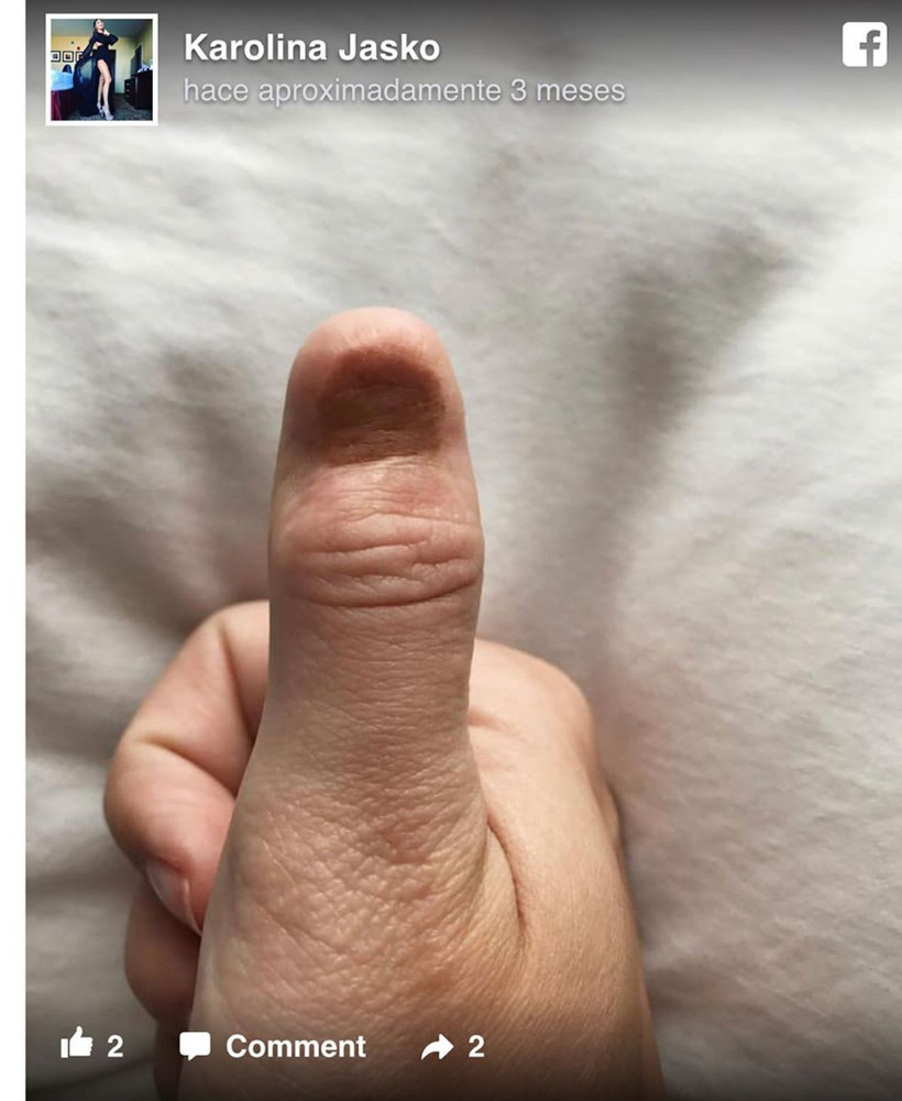 Şans eseri öğrenmişti Ünlü model kanseri böyle atlattı - Resim: 4