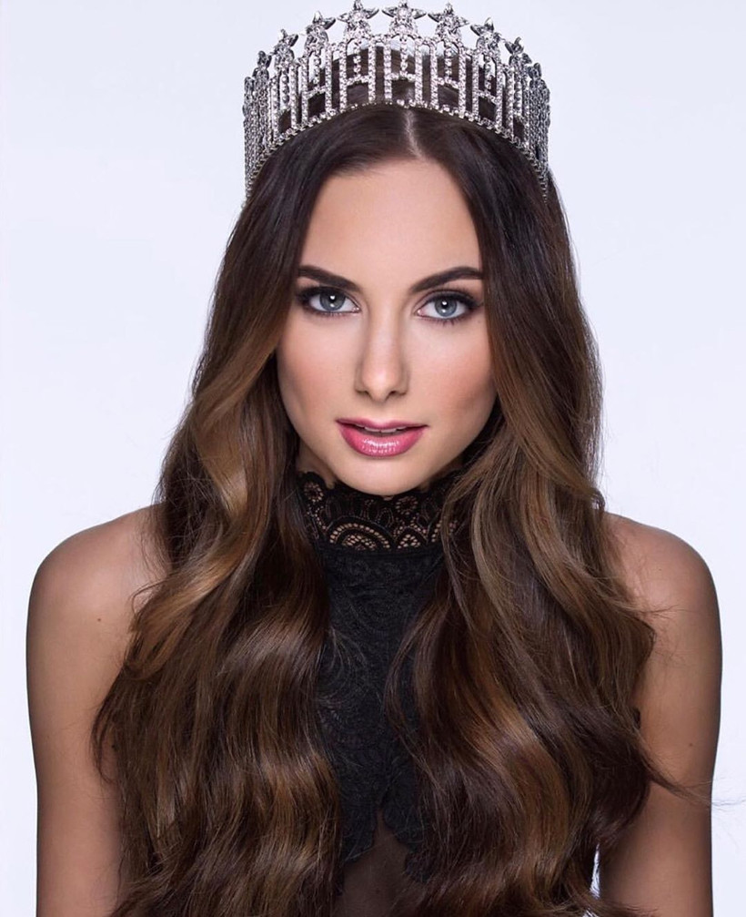 Şans eseri öğrenmişti Ünlü model kanseri böyle atlattı - Resim: 3