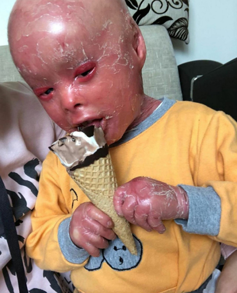 Balık pulu hastası Mehmet Emir'e Haluk Levent'ten büyük destek! - Resim: 1