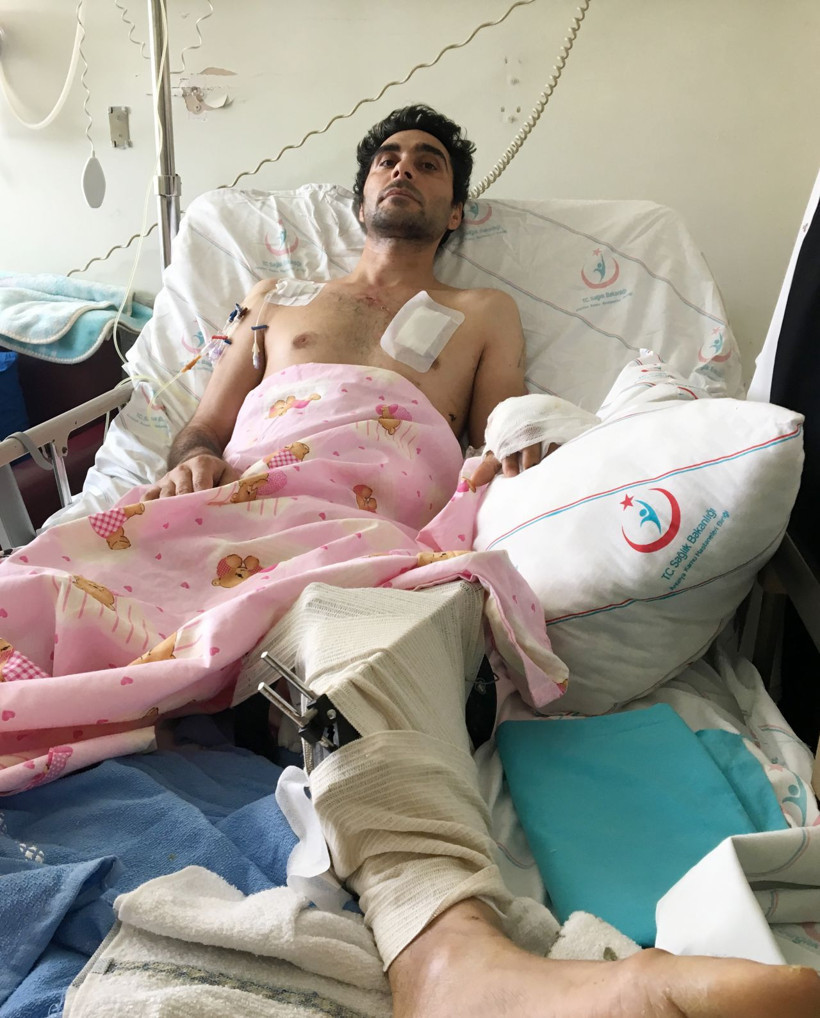 Antalya'da 80 santimlik demir bacağından girdi ciğerine saplandı - Resim: 2