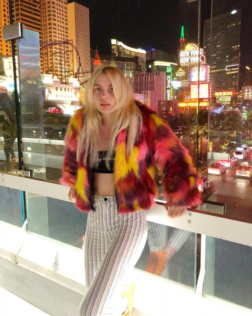 'Beni canlı gören halüsinasyon sanıyor'  - Resim: 3