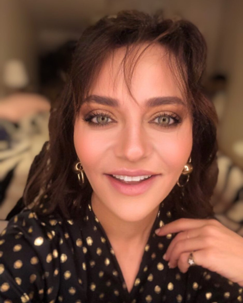 Diriliş Ertuğrul'un güzel oyuncusu sahte doktor kurbanı Son hali şoke etti - Resim: 4