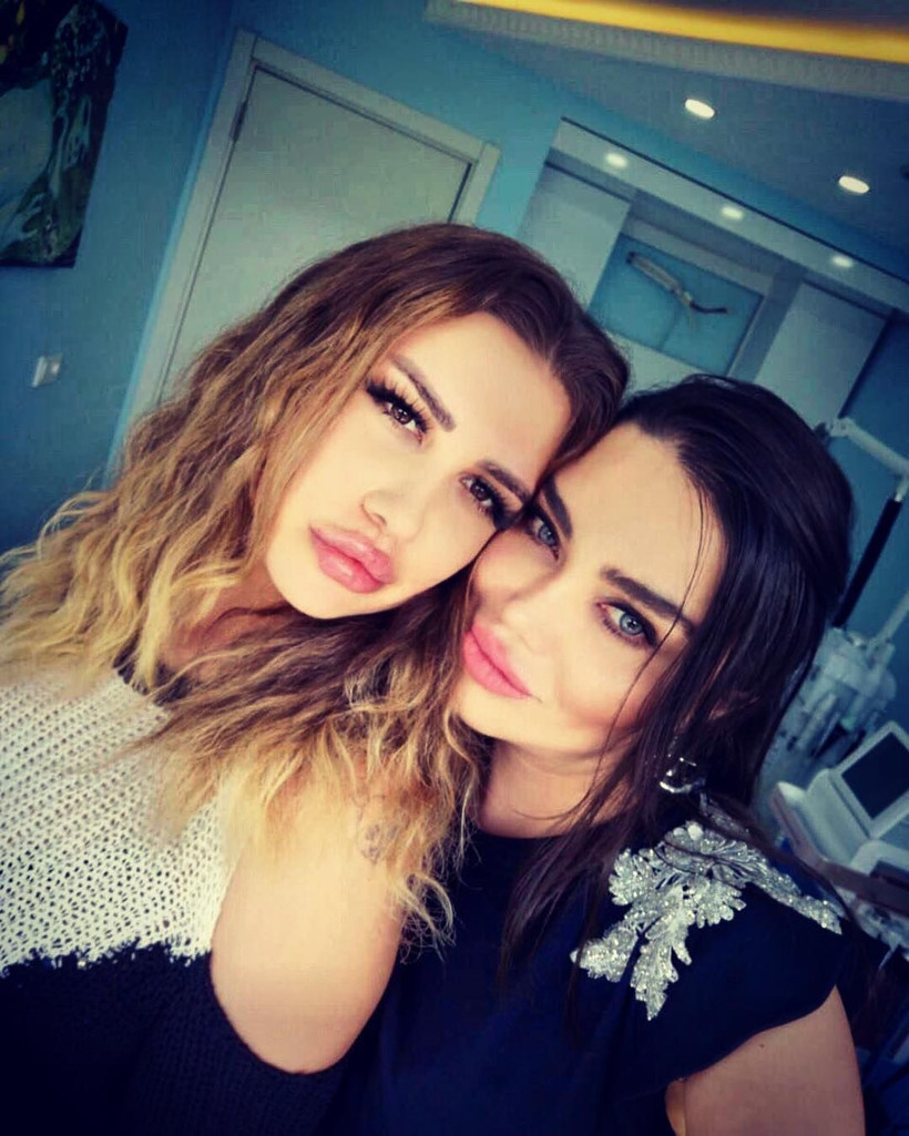 Gelin adayı Melis Buse Betkayan estetik yaptırdı son hali olay oldu - Resim: 2