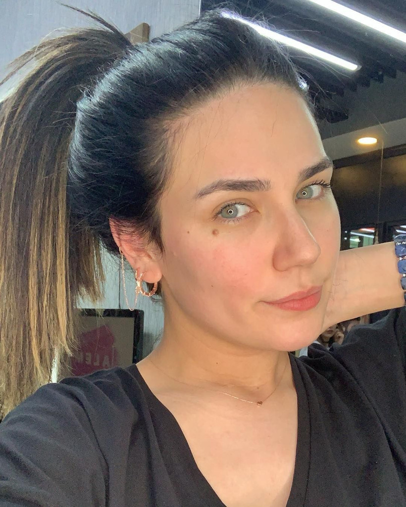 Alişan'ın eşi Buse Varol doğumdan sonra eridi! Bakın kaç kilo - Resim: 4