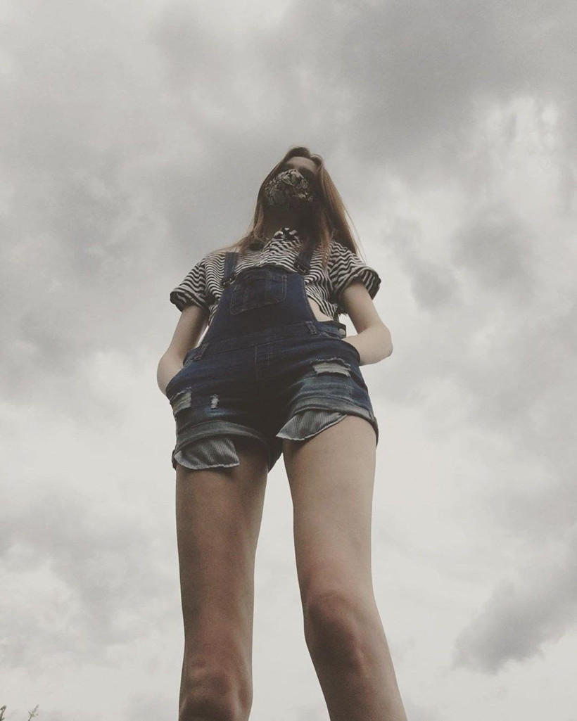 İşte dünyanın en uzun bacaklı kişisi! Sol bacağı 1 santimetre uzun - Resim: 1