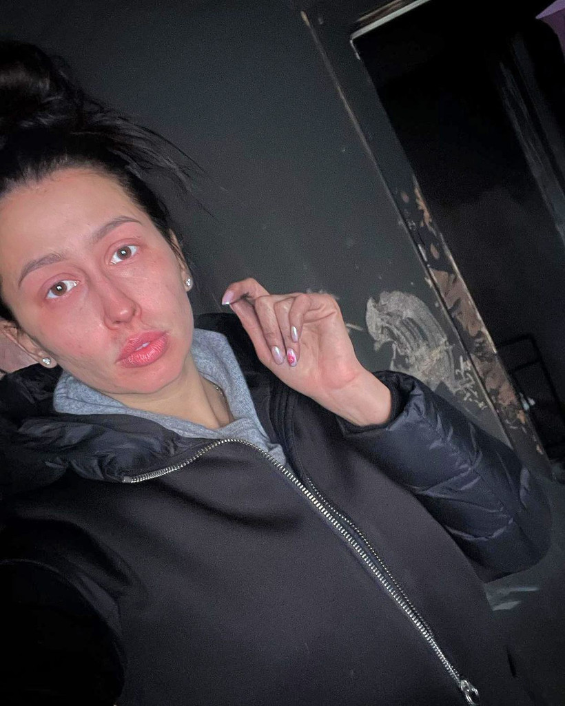 Korona oldu yanarak ölüyordu! Koku duyusunu kaybeden milli jimnastikçi faciadan döndü - Resim: 1