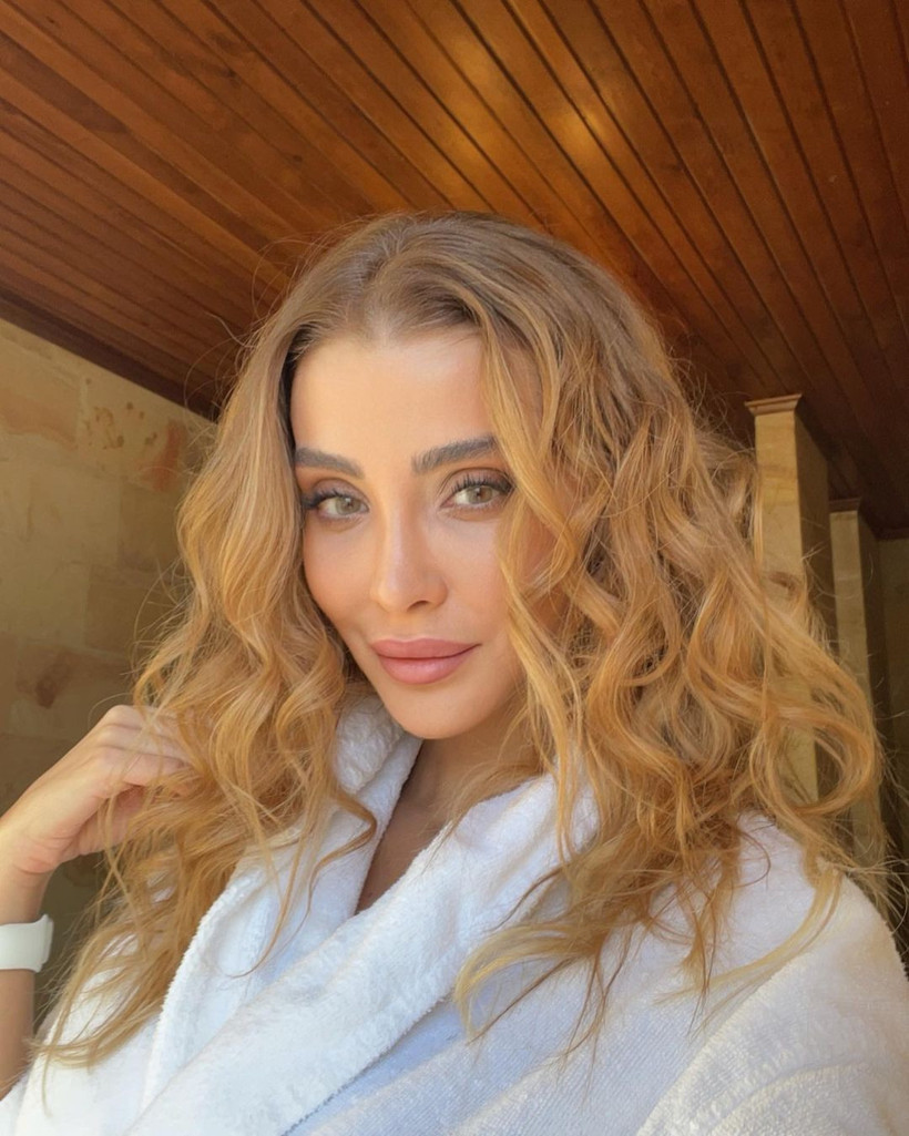 Özge Ulusoy 'ilk estetiğim' deyip paylaştı yine kimse inanmadı olay değişim - Resim: 3