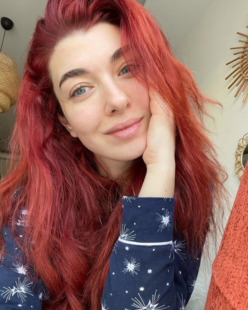 Aslıhan Güner'in son halini gören tanıyamadı! Sırrını açıkladı: En yakın arkadaşınızla... - Resim: 3