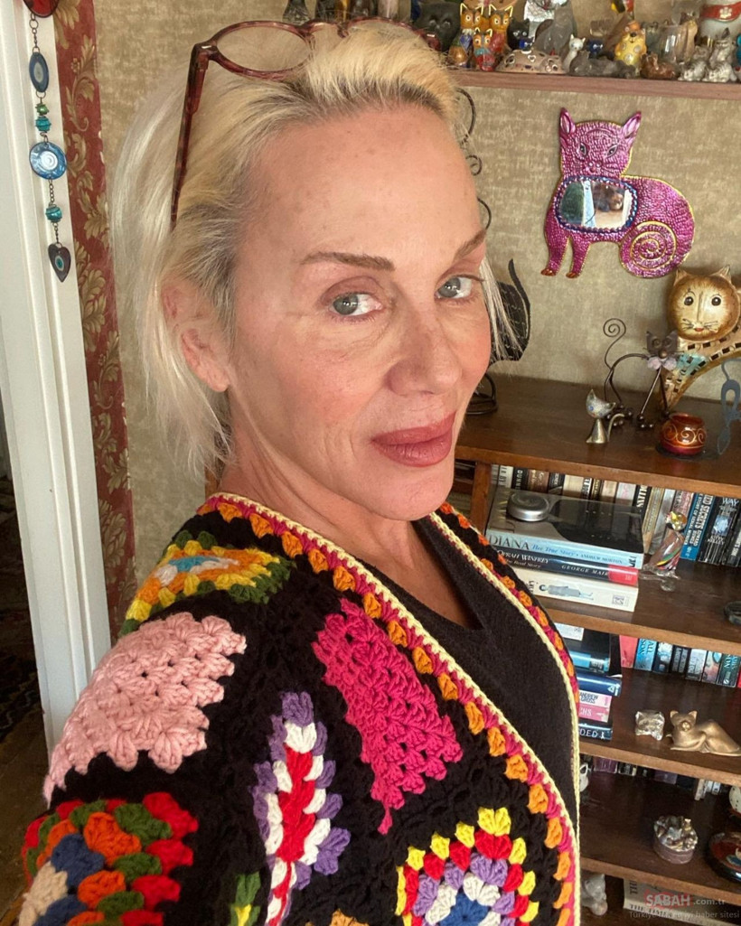 Akciğer kanseriyle savaşan Billur Kalkavan: "Kabulde ve akıştayım. Böylesi daha kolay." - Resim: 1