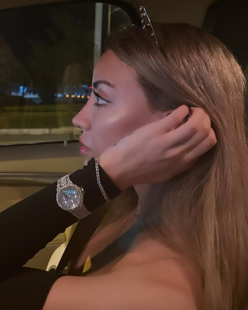 Mika Raun'un son hali görenleri şok etti! Estetik mağduru... - Resim: 4