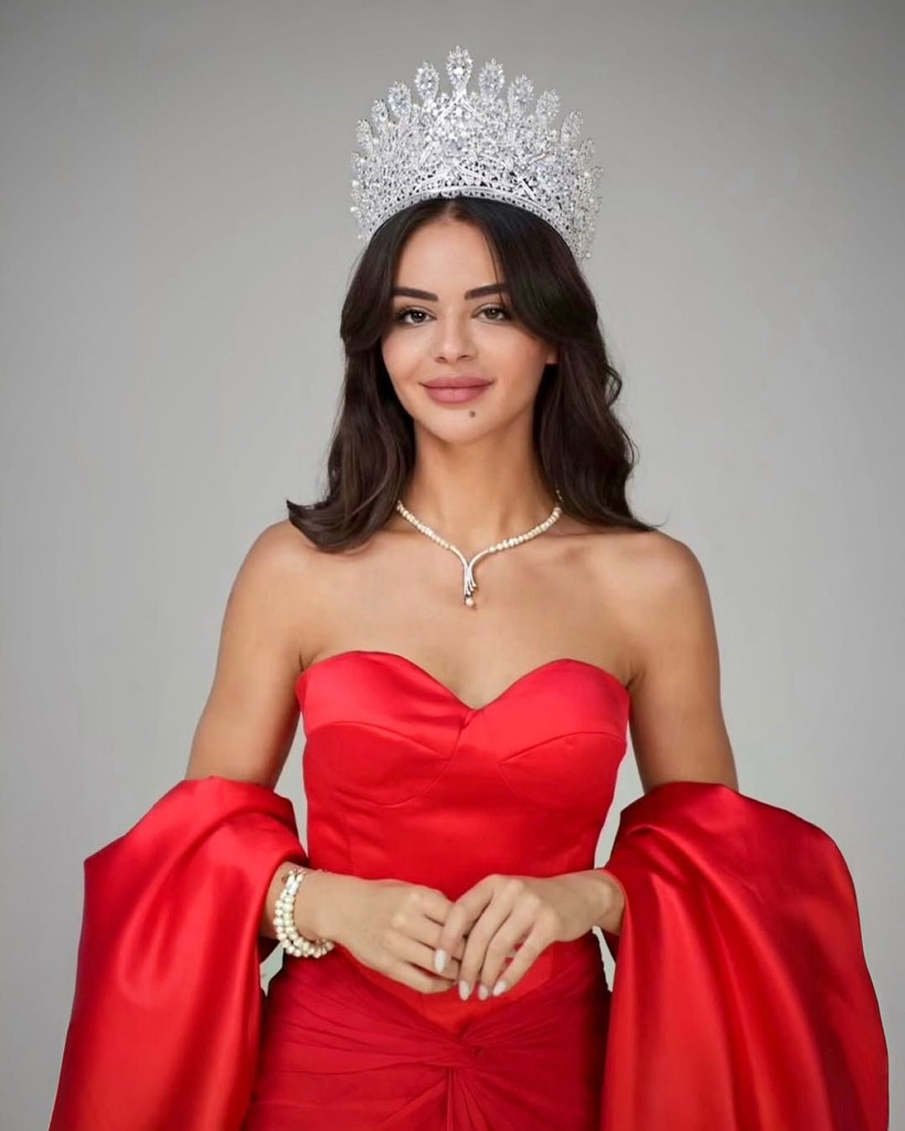 Türkiye'yi temsil edecek Ayşe Sena Şeref botokslu dendi işte olay olan güzel - Resim: 2