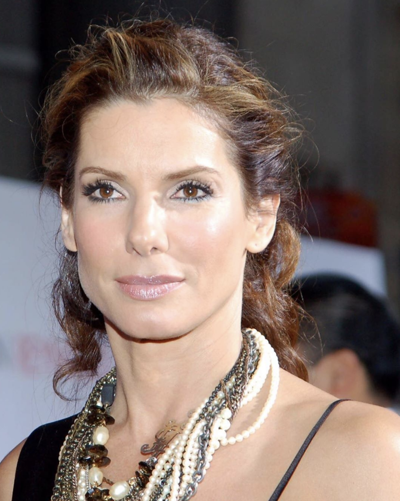 Sandra Bullock genç görünmek için yüzüne çocuk derisi enjekte ettiriyor! - Resim: 2