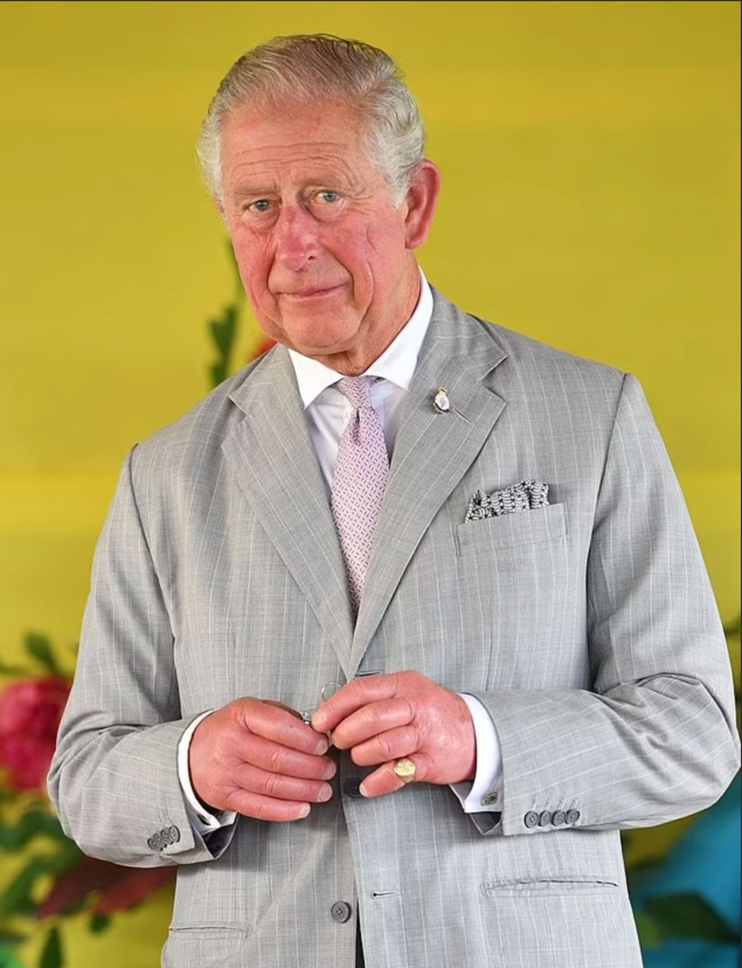 İngiltere Kralı Charles'in hastalığı ne? Sosis parmaklarından endişe yarattı - Resim: 3