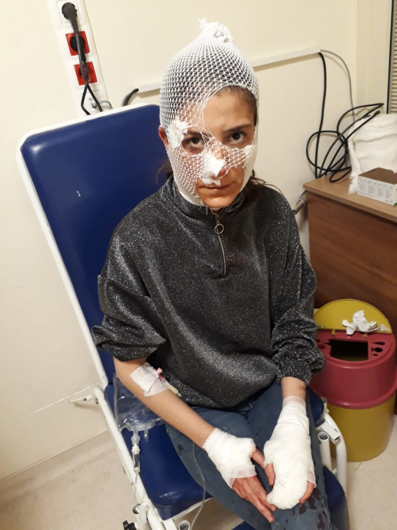 Platonik aşk dehşeti genç kadına 80 dikiş atıldı - Resim: 1