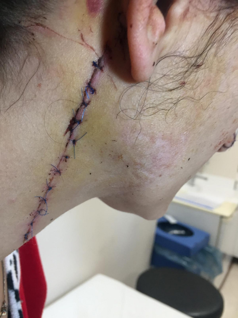 Platonik aşk dehşeti genç kadına 80 dikiş atıldı - Resim: 3