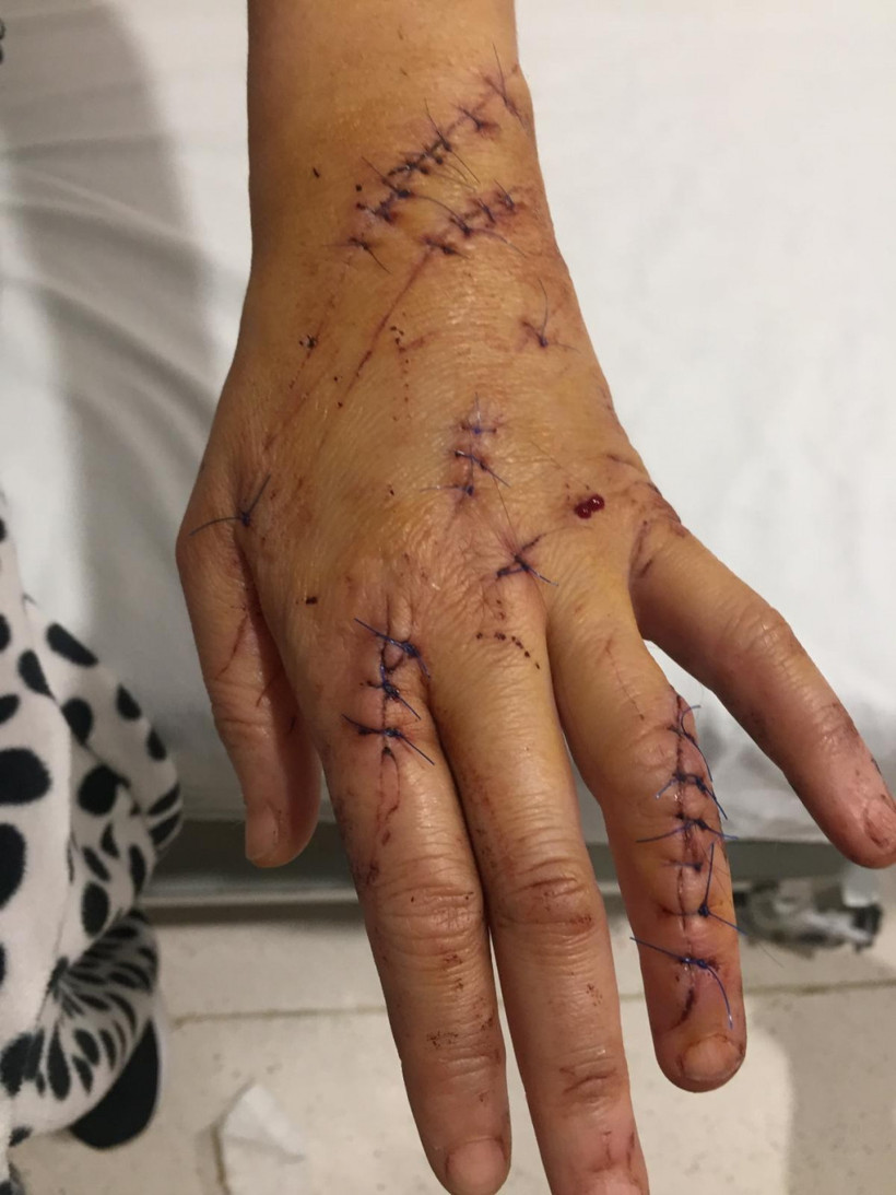 Platonik aşk dehşeti genç kadına 80 dikiş atıldı - Resim: 4