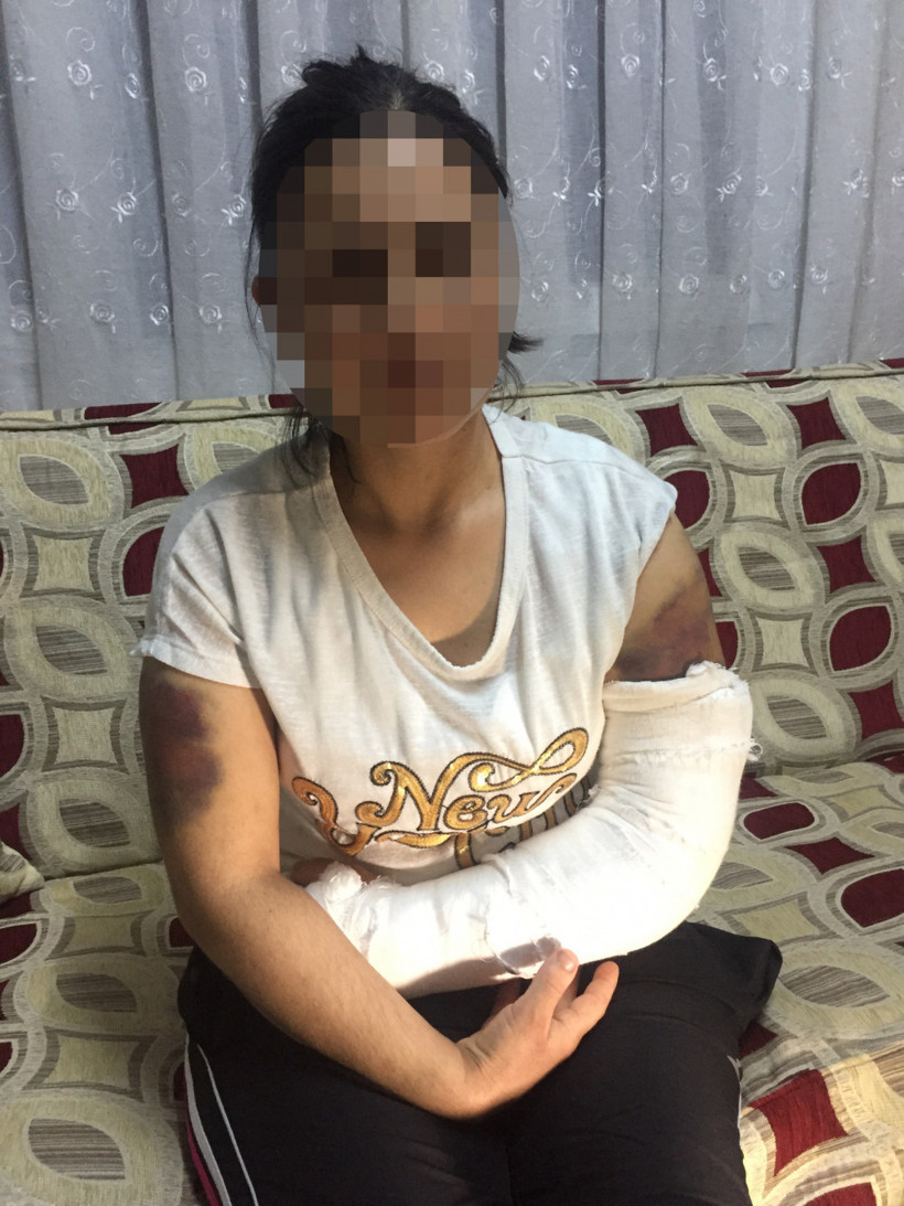 Kendisini aldattığını düşündüğü karısını inşaat demiriyle dövdü - Resim: 3