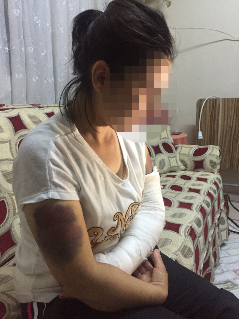 Kendisini aldattığını düşündüğü karısını inşaat demiriyle dövdü - Resim: 4