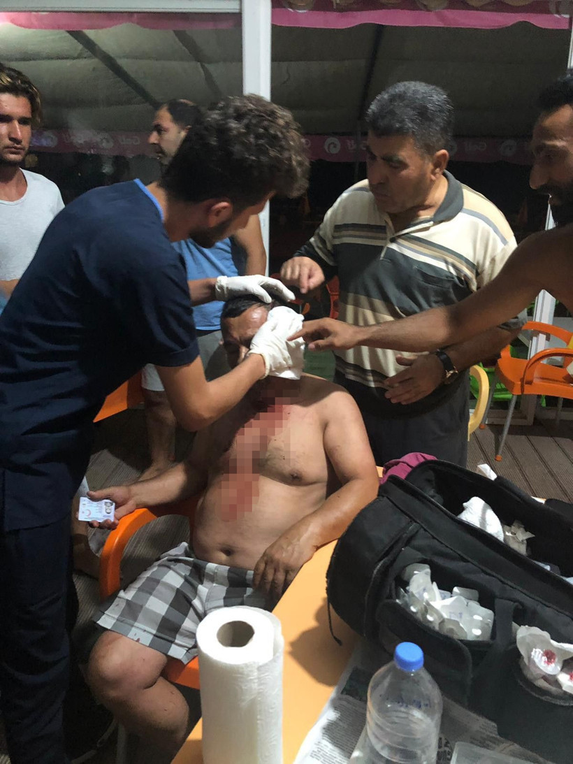 Gürültü yüzünden uyardıkları grubun saldırısına uğradılar - Resim: 2