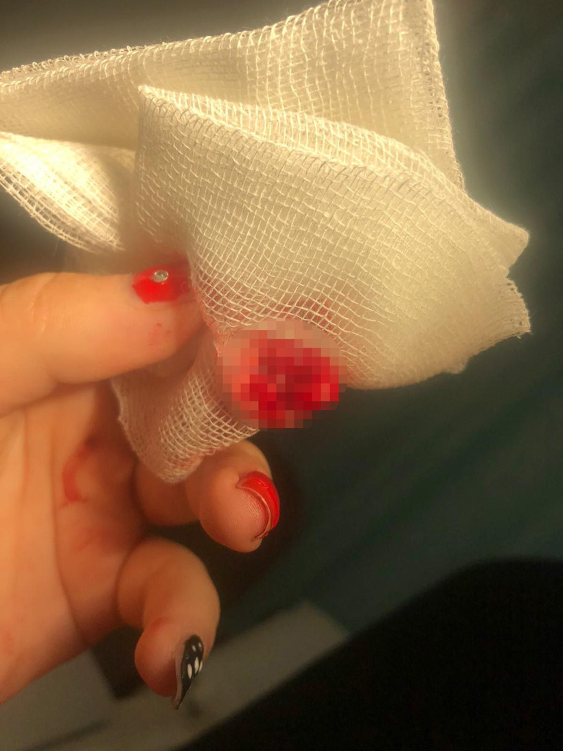 Sinop'ta akılalmaz olay genç kızın yemeğe gittiği köftecide parmağı koptu - Resim: 4