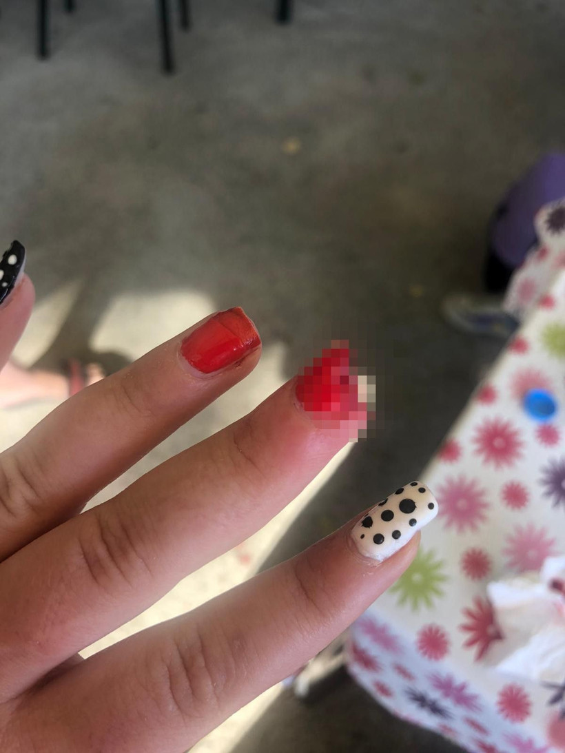 Sinop'ta akılalmaz olay genç kızın yemeğe gittiği köftecide parmağı koptu - Resim: 2