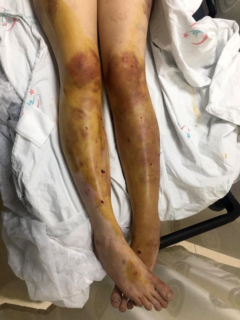 Şanlıurfa'da kan donduran olay! Eşini eve kilitleyip işkence yaptı kerpetenle tırnaklarını söktü - Resim: 3